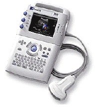 Lease SonoSite Ultrasound Machine